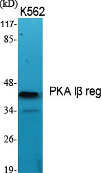 PKA I beta reg antibody