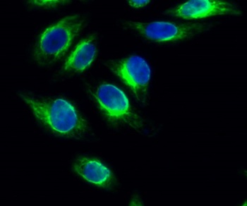 PKD1 rabbit pAb