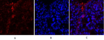 PKM2 antibody