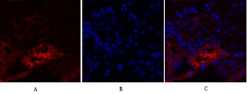 PKM2 rabbit pAb Antibody
