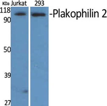 Plakophilin 2 antibody