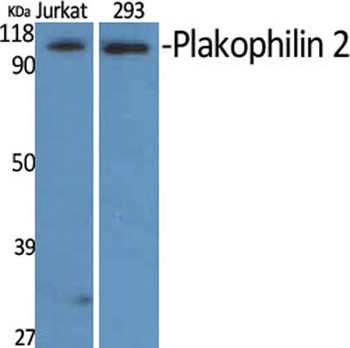 Plakophilin 2 rabbit pAb