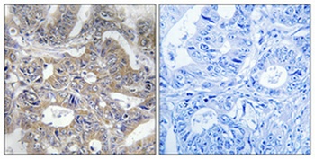 POLR3E rabbit pAb Antibody