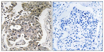PP2A-Aβ rabbit pAb Antibody
