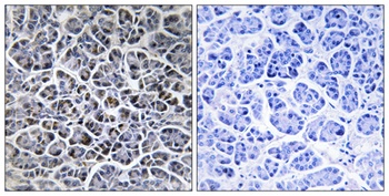PP2Cκ rabbit pAb Antibody