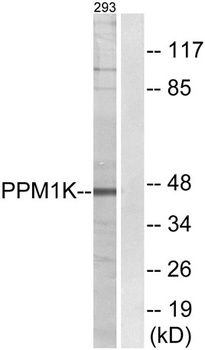 PP2Cκ rabbit pAb Antibody