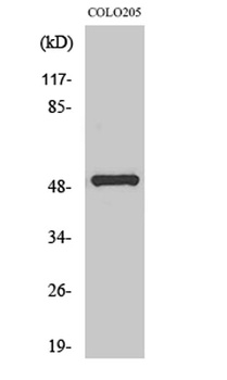 PPP4R1L antibody