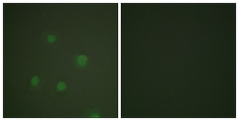 PR rabbit pAb Antibody