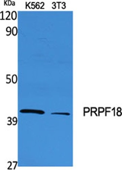 PRPF18 antibody