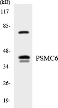 PSMC6 rabbit pAb