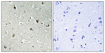PU.1 rabbit pAb Antibody