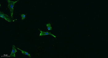 PUMA antibody