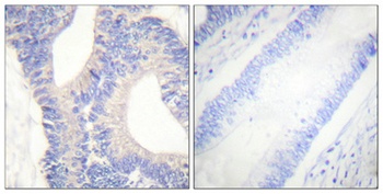 PYK2 rabbit pAb Antibody