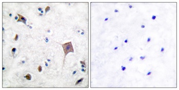 PYK2 rabbit pAb Antibody