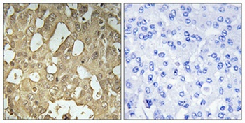 Rabaptin-5β rabbit pAb Antibody
