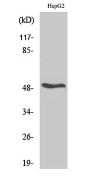 RAR beta antibody