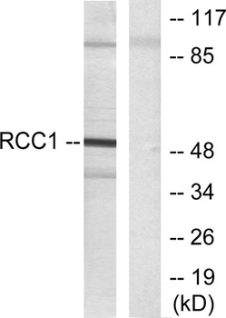 RARβ rabbit pAb Antibody