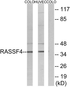 RASSF4 rabbit pAb Antibody