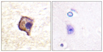 Ret rabbit pAb Antibody