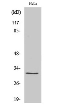 Ribosomal Protein S2 antibody
