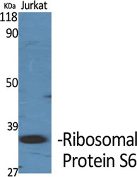 Ribosomal Protein S6 antibody