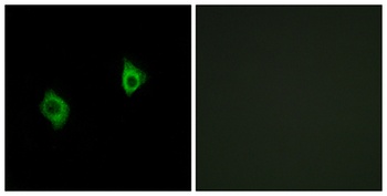 Ribosomal Protein S9 rabbit pAb Antibody