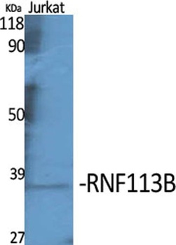 RNF113B rabbit pAb