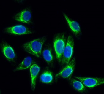 Rock-1 antibody