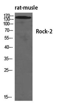 Rock-2 antibody