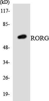 ROR gamma antibody