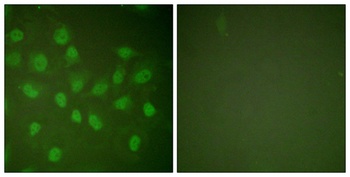 Rpb1 rabbit pAb Antibody