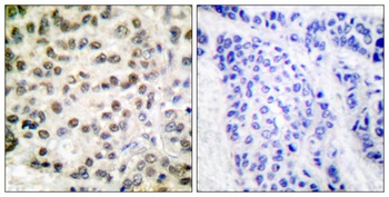 Rpb1 rabbit pAb Antibody
