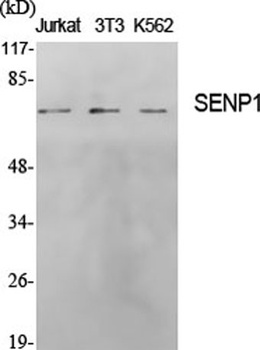 SENP1 antibody