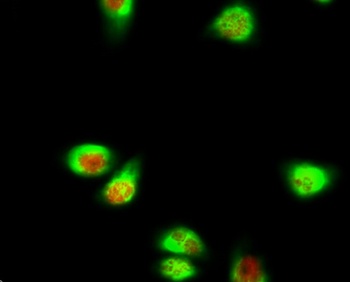 SGK1 antibody