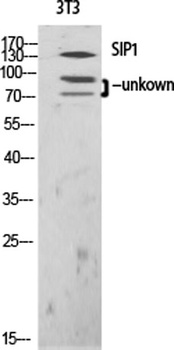 SIP1 antibody