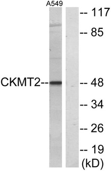 sMtCK rabbit pAb Antibody