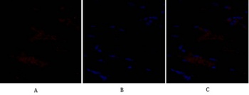 SNAI 1 antibody