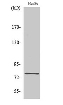 SnoN antibody