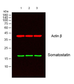 Somatostatin antibody