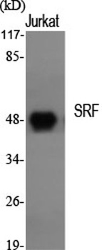 SRF antibody