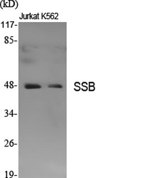 SSB antibody