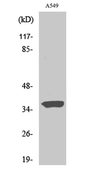 STEAP1 antibody
