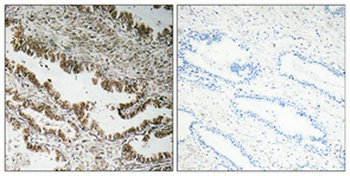 STEAP1 rabbit pAb Antibody