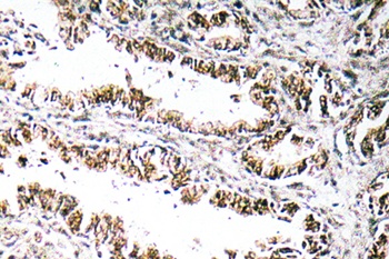 STEAP1 rabbit pAb Antibody