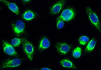 SUMO-1 antibody