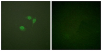 SUMO-1 rabbit pAb Antibody
