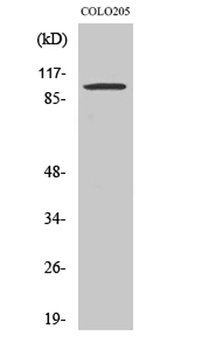 Synphilin-1 antibody