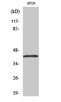 TBX10 antibody