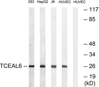 TCEAL6 rabbit pAb Antibody