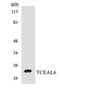 TCEAL6 rabbit pAb Antibody